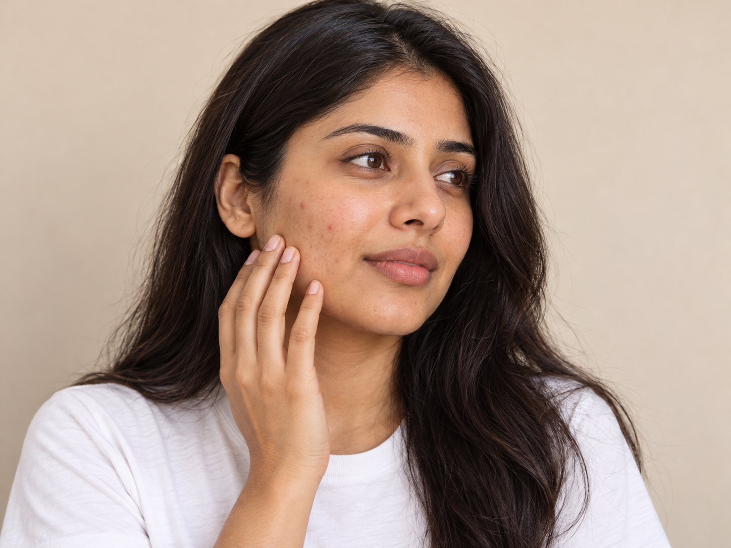 Woman with acne-prone skin gently touching her cheek